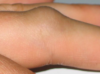 finger 1
